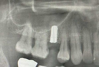 特殊歯科・口腔外科イメージ02
